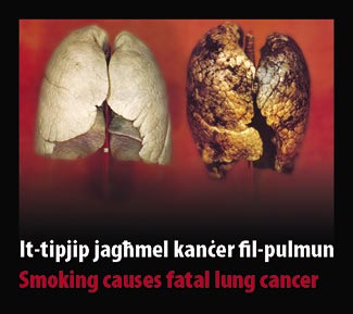 Malta 2009 Health Effects lung - diseased organ, lung cancer, gross